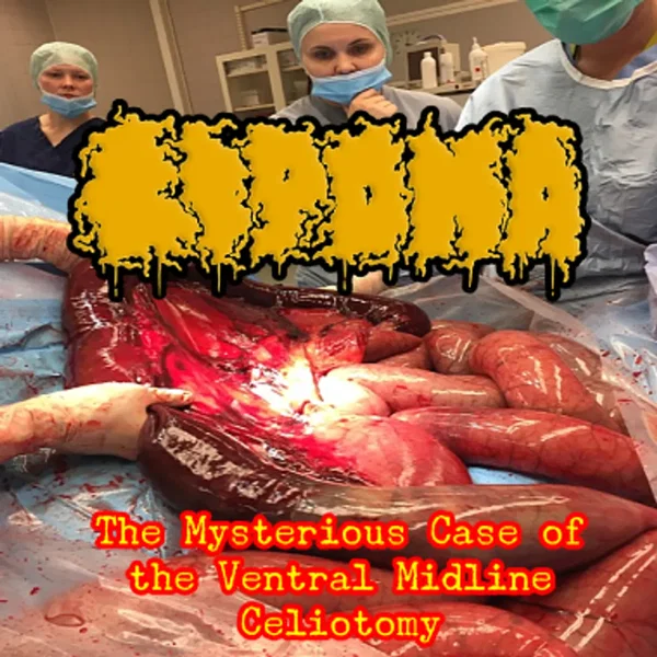 The Mysterious Case of the Ventral Midline Celiotomy