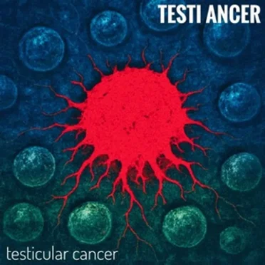 Testicular Cancer