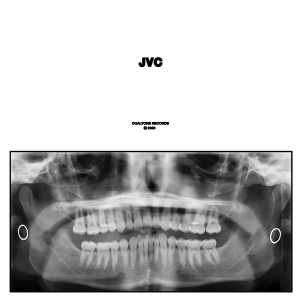 JVC
