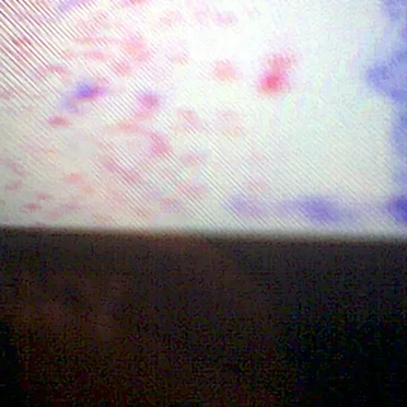 Dégradaction improvisoire