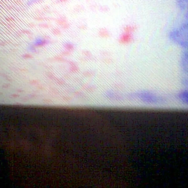 Dégradaction improvisoire