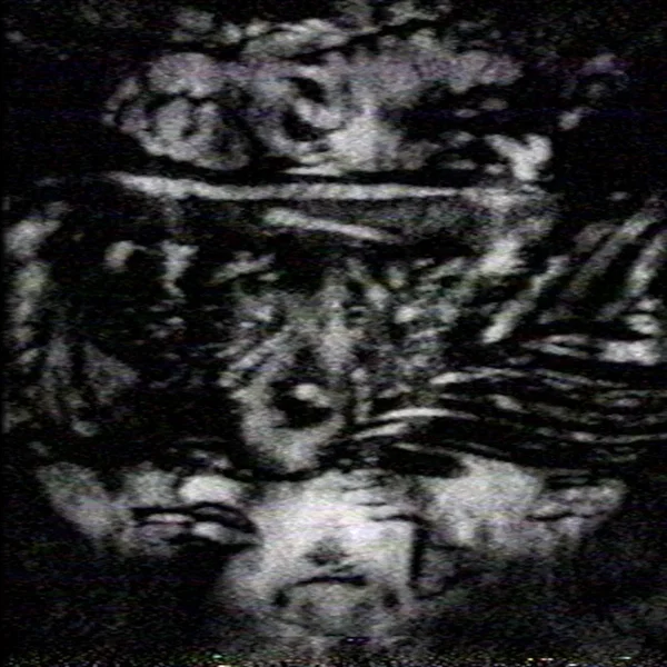 DYNASTINAE