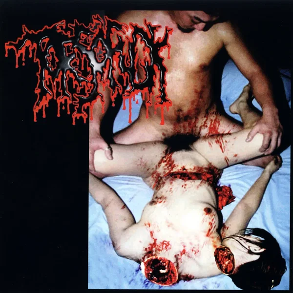 Disgusting Gore and Pathology / Polymorphisms to Severe Sepsis in Trauma