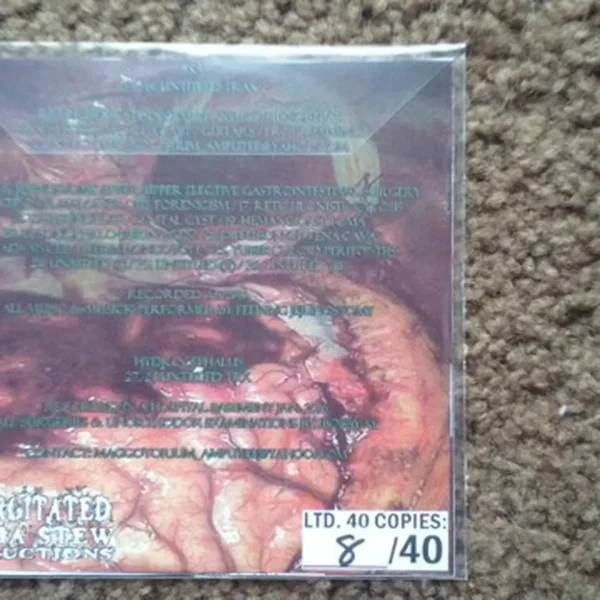 3-Way Autopsy