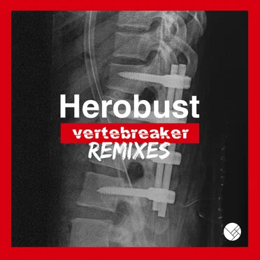 Vertebreaker Remixes