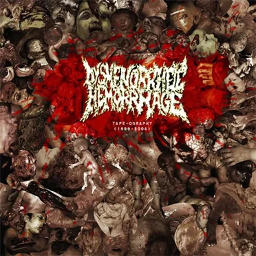Dysmenorrheic Hemorrhage