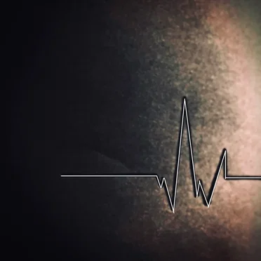 sinus rhythm