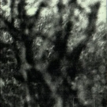 Somnambulism in a Verdigris Field