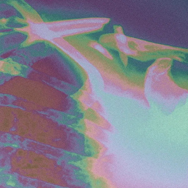 Broken Wings