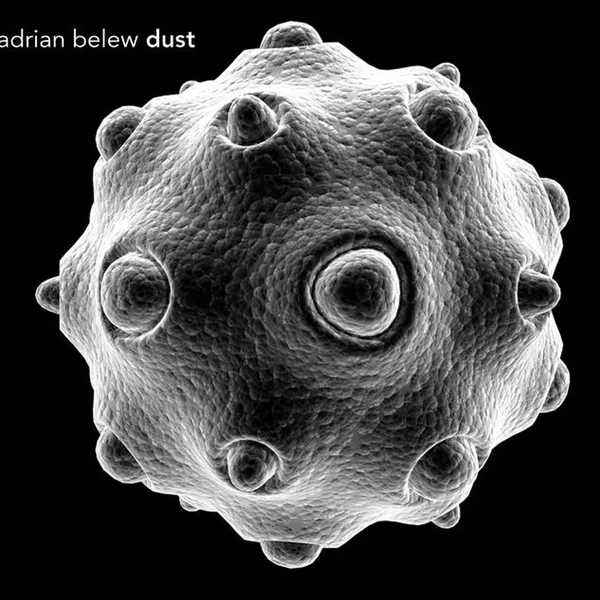 Dust