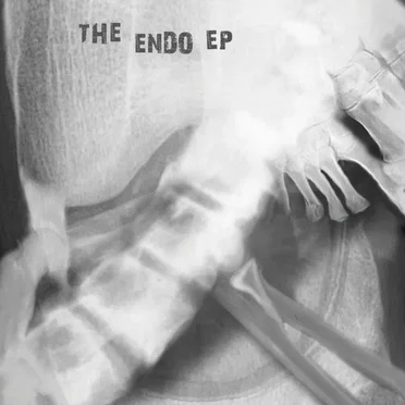 The Endo EP