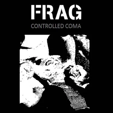 Controlled Coma