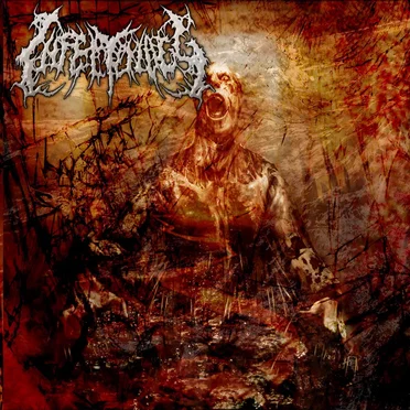 Intracranial Trinity