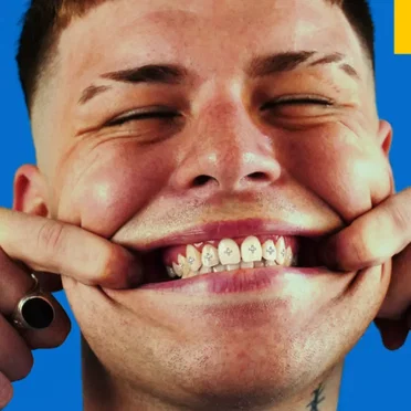 POSITIVO by Knak - album cover