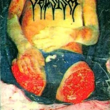 Severe Carnal Butchery by Sepsism - album cover
