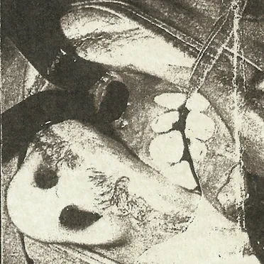 Collapsed Amalgam