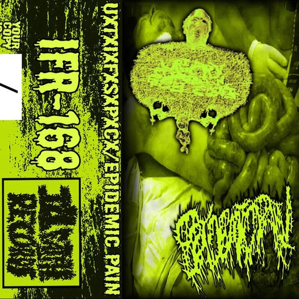 UxTxIxFxSxPxCx / Epidemic Pain