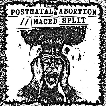 Maced / Postnatal Abortion