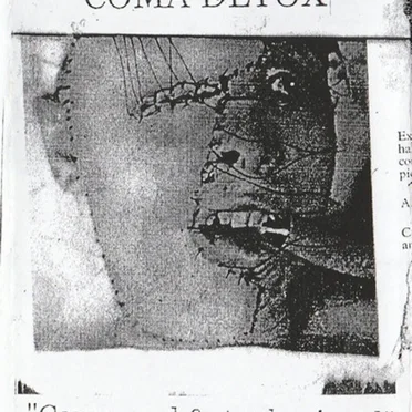 Concussed & Asphyxiated by Coma Detox - album cover