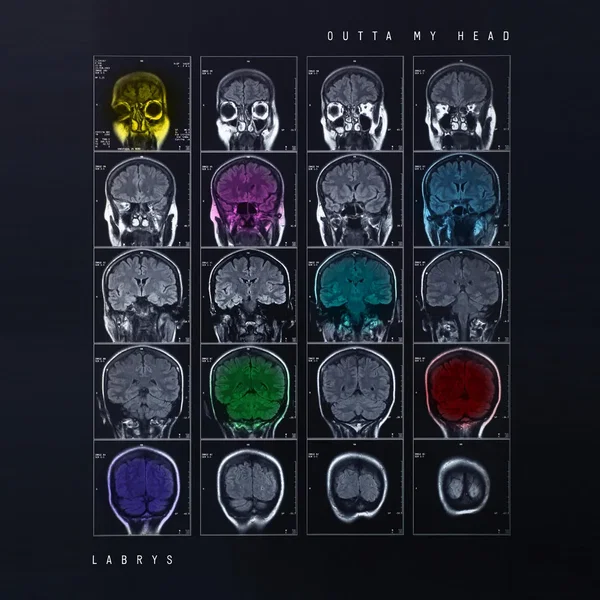 OUTTA MY HEAD