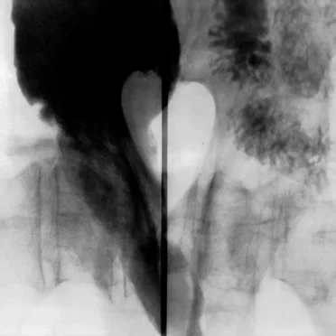 KK Null, The Noiser & Bruital Orgasme