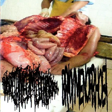 Hydropneumothorax / Bradymenorrhoea