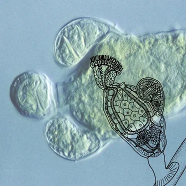 Pseudoceloma