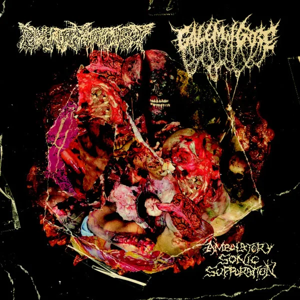 Ambulatory Sonic Suppuration