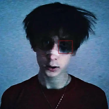 kék folt