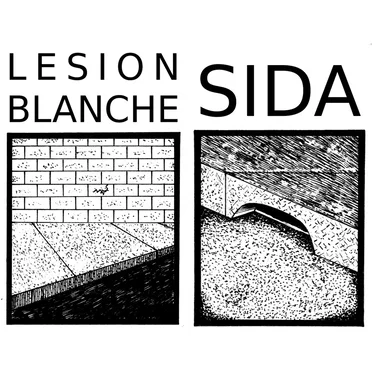 Lésion Blanche / SIDA (K7 split) by Sida - album cover