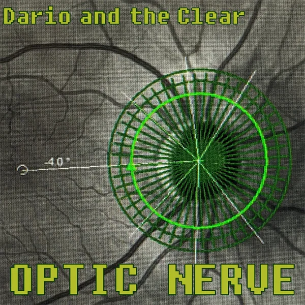 Optic Nerve