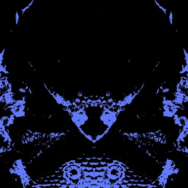 Hypersomnia