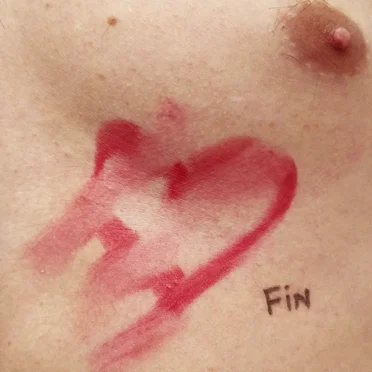 Fin