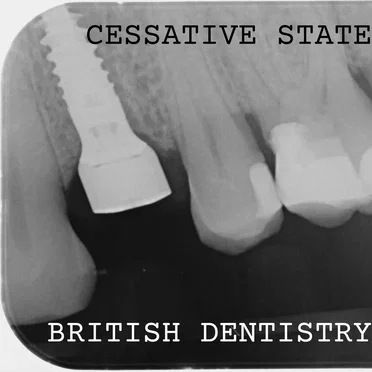British Dentistry by Cessative State - album cover
