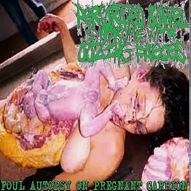 Foul Autopsy on Pregnant Carrion