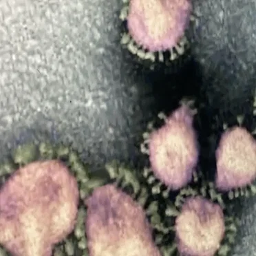 oolXloo: Virus Singles
