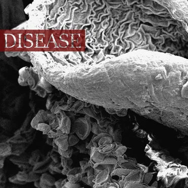 DISEASE