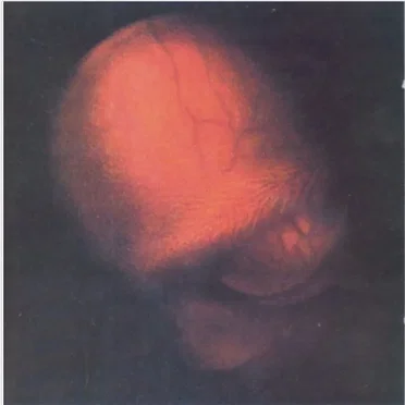 Tweezer by Tweezer - album cover