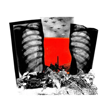 Teeth - Anthony Naples Remix