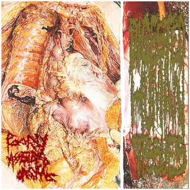 Poorly Assembled Organs by Digested Human Tissues - album cover