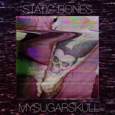 Static Bones