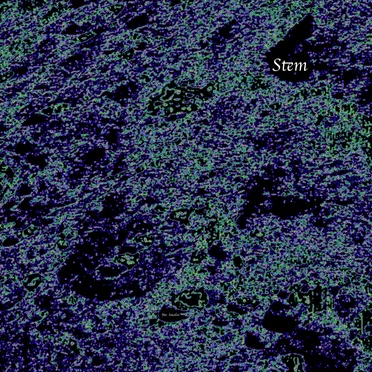 Stem