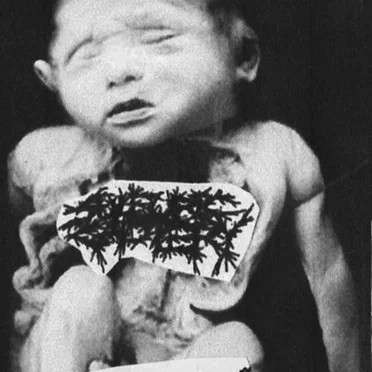 Plague / Sulfuric Cautery / Accidental Homicide