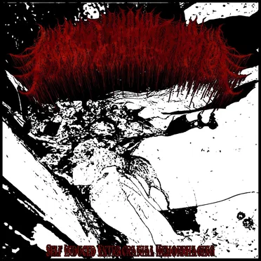 Self Induced Extracranial Hemorrhaging
