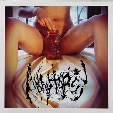Anautopsy by Anautopsy - album cover