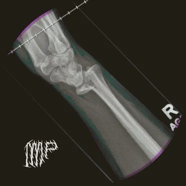 Fractured