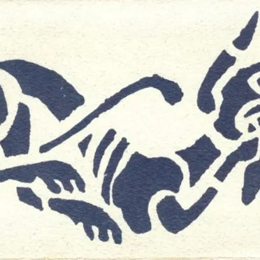 Anasarca