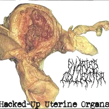 Hacked-Up Uterine Organs