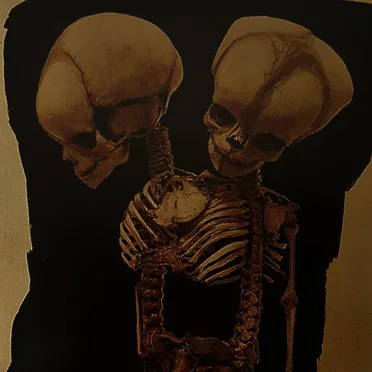 Suddenly, Not by We Also Let Blood - album cover