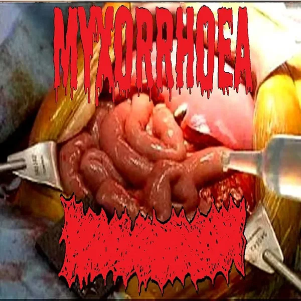 Myxorrhoea / Bowel Fermentation